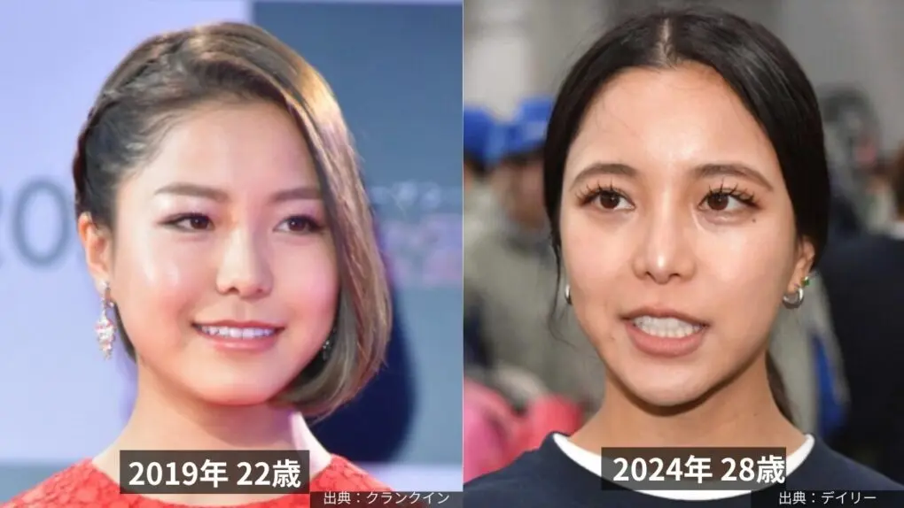 高梨沙羅の22歳と28歳の顔の変化画像