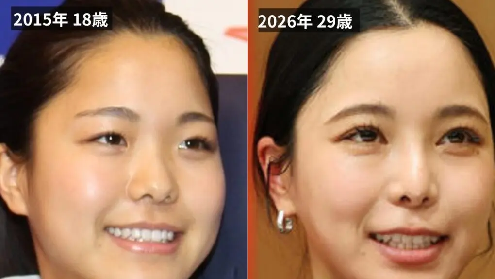 高梨沙羅の顔の変化を比較画像で検証